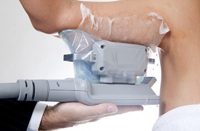 fat freezing arms Rickmansworth