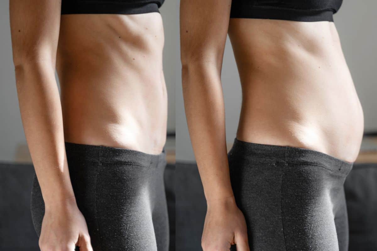 How long does diastasis recti take to improve Rickmansworth?
