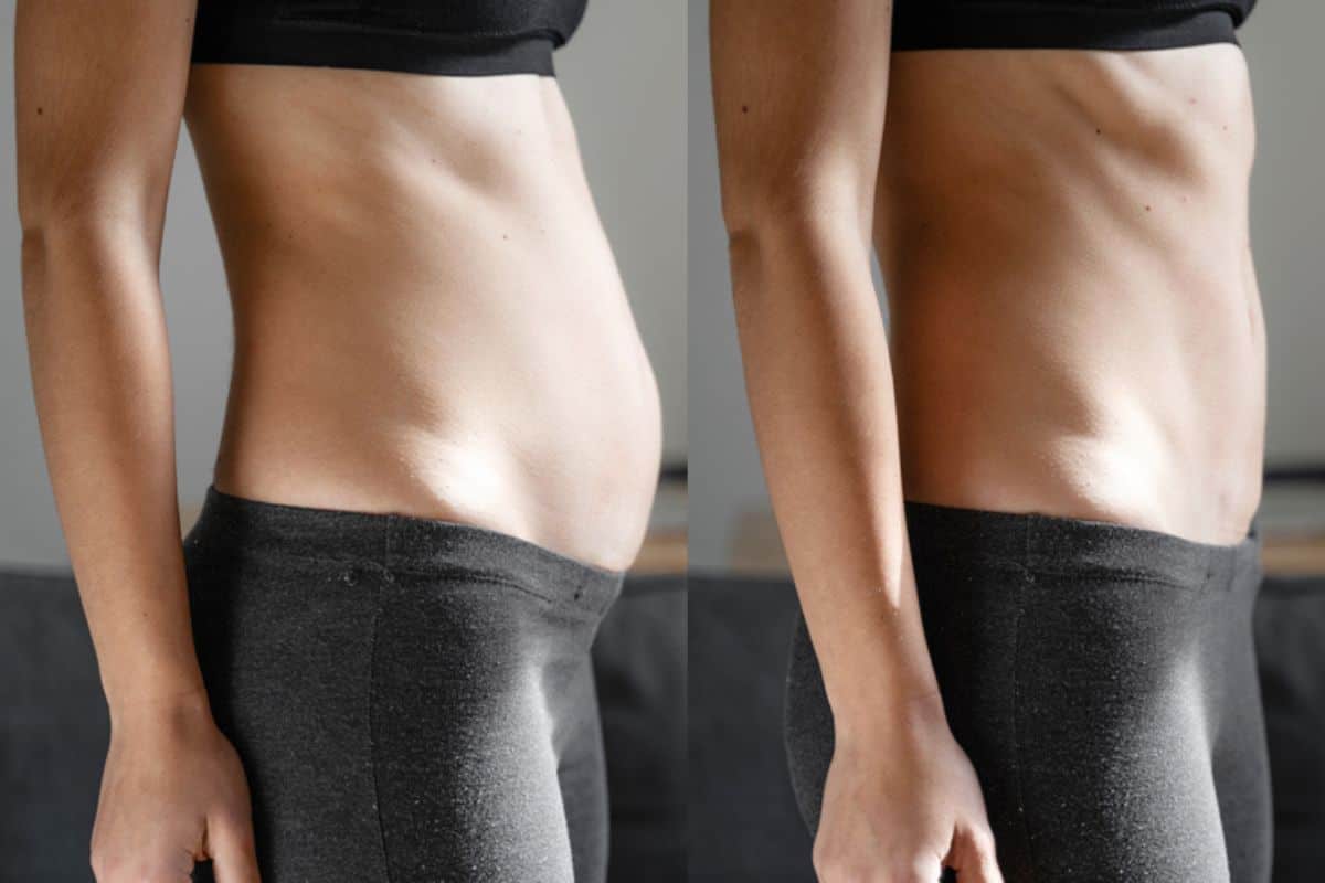 Post-Pregnancy: What Happens to Your Abdominal Muscles After Birth Rickmansworth