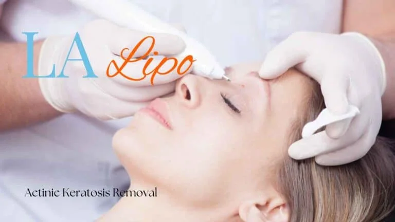 Woman receiving Actinic Keratosis Removal Treatment Rickmansworth