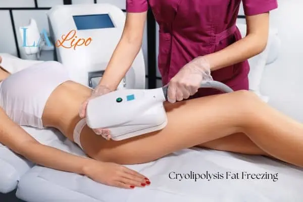 Woman receiving coolsculpting Rickmansworth treatment on her thighs