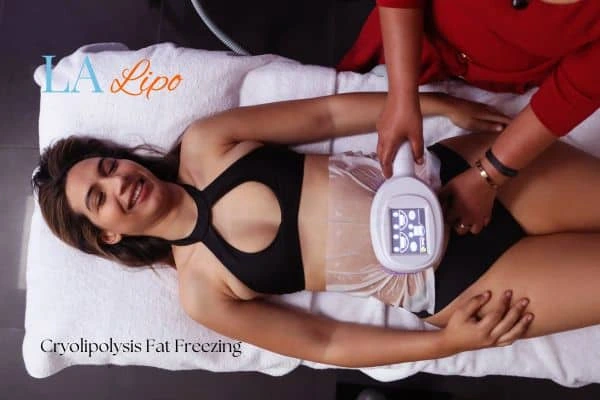 woman getting cryolipolysis Rickmansworth
