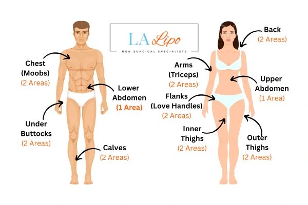 LA LIPO Cryolipolysis Areas Rickmansworth