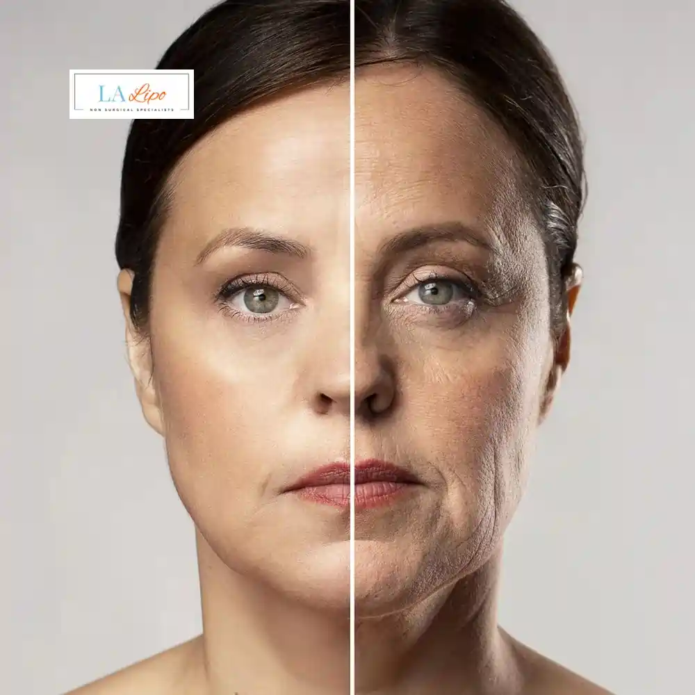 How Can You Tell If Non-Surgical Skin Tightening Is Right for You Rickmansworth?