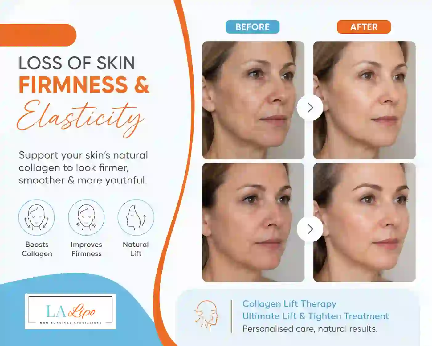Sign #7: Loss of Skin Firmness and Elasticity Rickmansworth