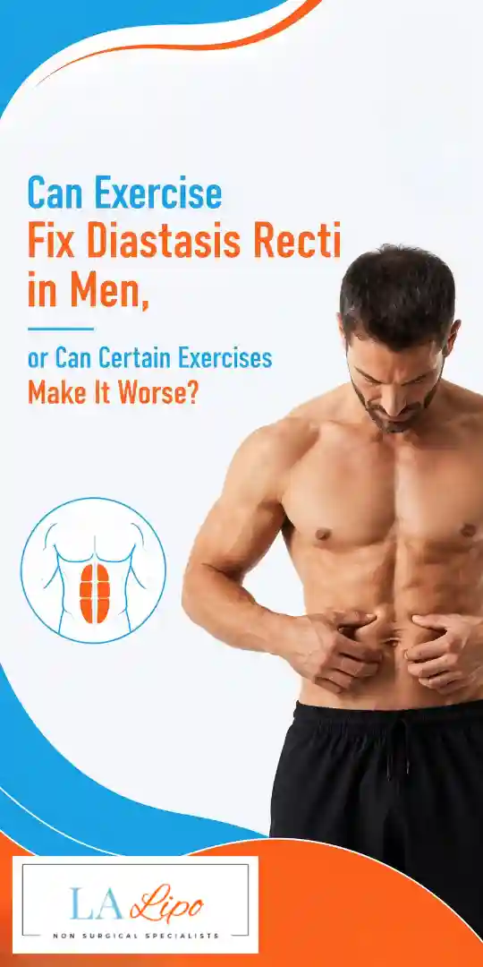 Can Exercise Fix Diastasis Recti in Men, or Can Certain Exercises Make It Worse Rickmansworth?