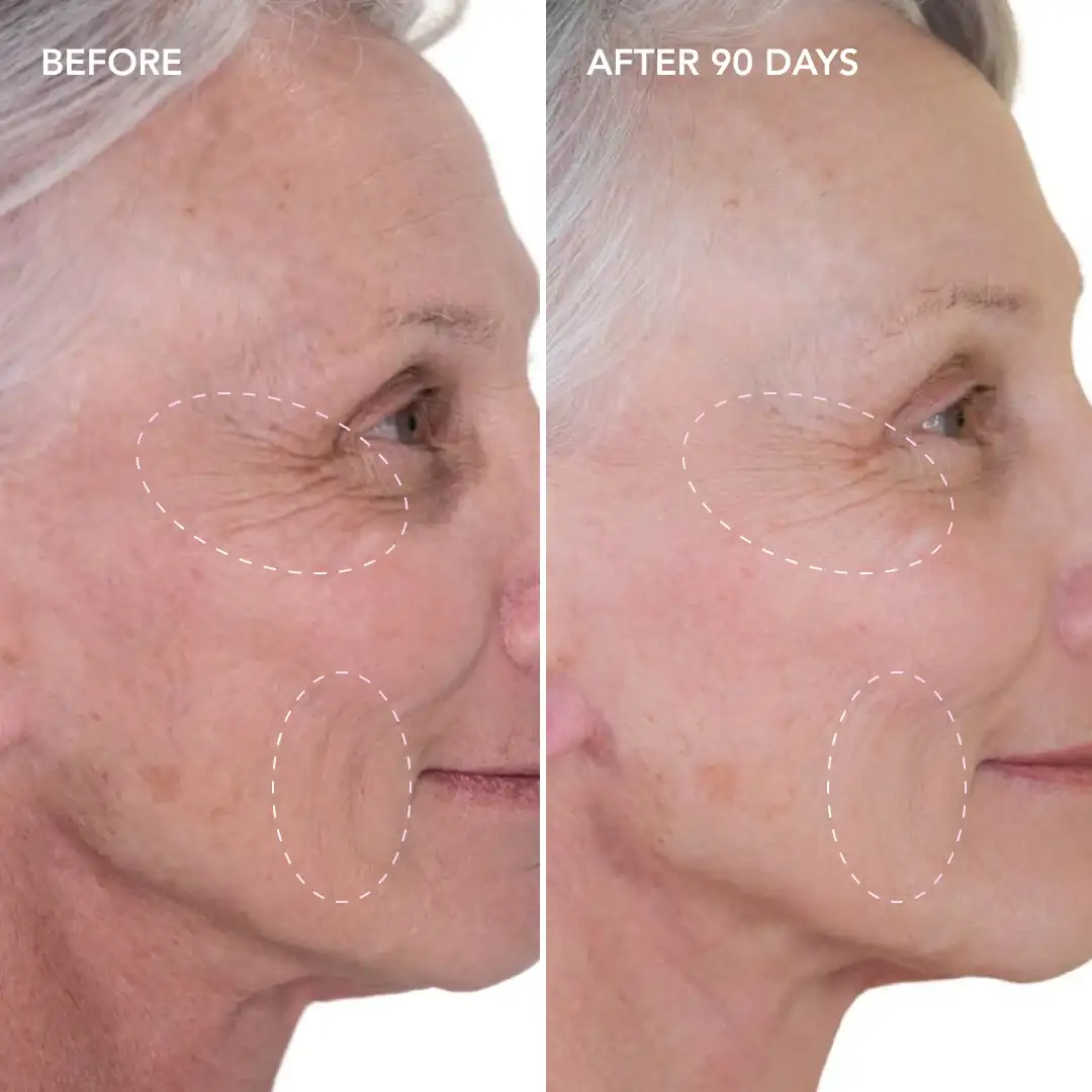 When will you see results Rickmansworth